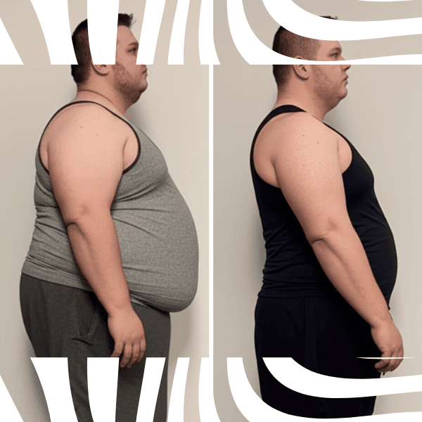 Before and After
